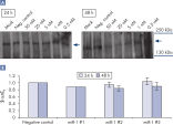 Regulación descendente a nivel proteico tras la transfección de miR-1 mimic.