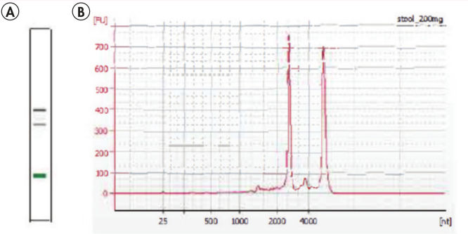 Figure 1. High-quality, intact total RNA isolated from human stool using the RNeasy PowerMicrobiome Kit.