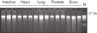 High-quality DNA from different tissue types fixed and stabilized in PAXgene Tissue Containers.