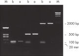 Eliminación completa de cebadores tras la PCR.