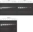 Sensitive PCR using DNA purified from preserved blood.