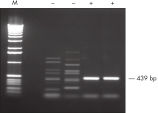 RT-PCR of GC-rich template.