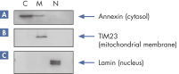 Separación específica de proteínas marcadoras.