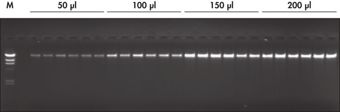 Gel d’agarose d’ADN génomique purifié.