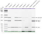 Breast cancer-associated gene expression.