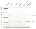 Figure 6: AdnaTest LungCancerDetect results of duplex PCR samples using an Agilent 2100 Bioanalyzer.