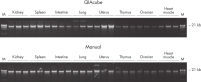 Comparison of manual and automated procedure: Agarose gel electrophoresis from sections of PAXgene Tissue-fixed, paraffin-embedded (PFPE) tissue.