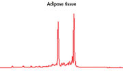 High-quality RNA from adipose tissue.