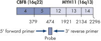 CBFB-MYH11 A fusion gene transcript.