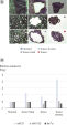 Nachweis der unterschiedlichen Expression von miRNAs in LMD-Proben aus FFPE-Gewebeschnitten