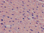 miR-1 detection in adult mouse heart.