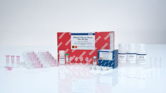 RNA Extraction Kits, RNA Isolation and Purification