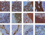 Immunohistochemistry (IHC) staining with the PAXgene Tissue System gives comparable results to formalin-fixed tissue.